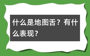 什么是地圖舌？有什么表現(xiàn)？