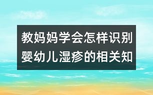 教媽媽學會怎樣識別嬰幼兒濕疹的相關(guān)知識