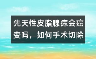 先天性皮脂腺痣會癌變嗎，如何手術切除