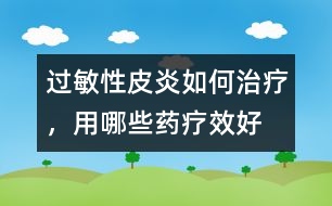 過敏性皮炎如何治療，用哪些藥療效好