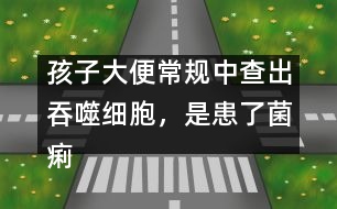 孩子大便常規(guī)中查出吞噬細胞，是患了菌痢