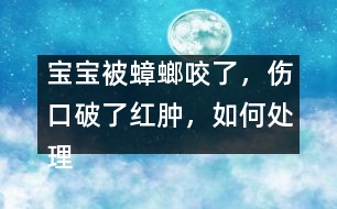 寶寶被蟑螂咬了，傷口破了紅腫，如何處理