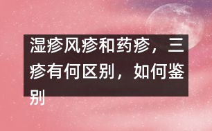 濕疹風(fēng)疹和藥疹，三疹有何區(qū)別，如何鑒別
