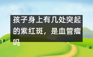 孩子身上有幾處突起的紫紅斑，是血管瘤嗎