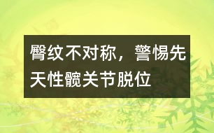 臀紋不對(duì)稱，警惕先天性髖關(guān)節(jié)脫位