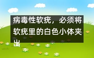 病毒性軟疣，必須將軟疣里的白色小體夾出