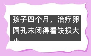 孩子四個月，治療卵圓孔未閉得看缺損大小