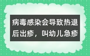 病毒感染會導致熱退后出疹，叫幼兒急疹