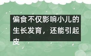 偏食不僅影響小兒的生長發(fā)育，還能引起皮膚病